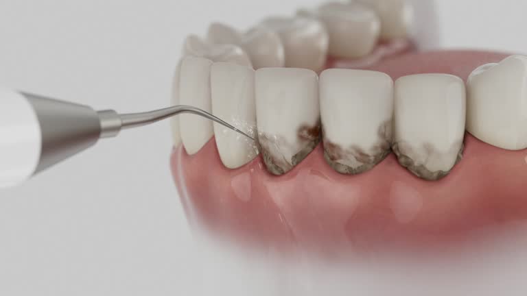 Trusted Teeth Whitening service in Monahans, TX - Dentist Open Now